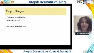 20231023 – AlerjimTV Ortak Yayını “Atopik Dermatit ve Alerji”